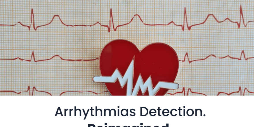 Arrhythmia-Detection