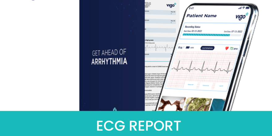 ECG-REPORT