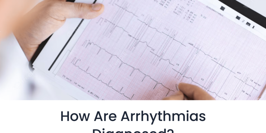 How-Are-Arrhythmias-Diagnosed