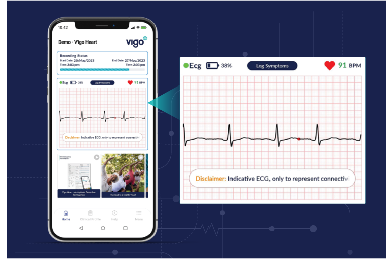 3. Start recording the ECG