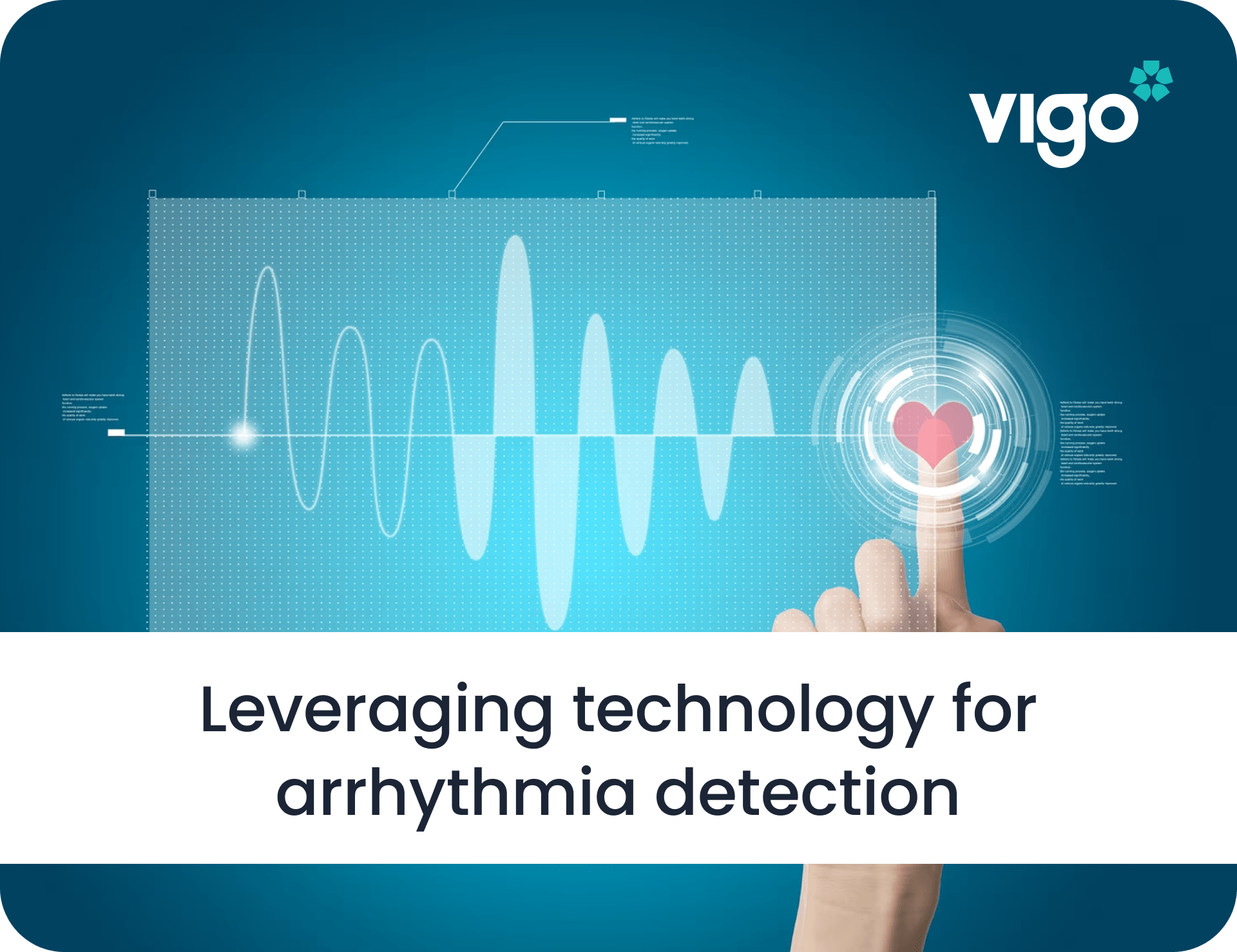 Leveraging technology for arrhythmia detection