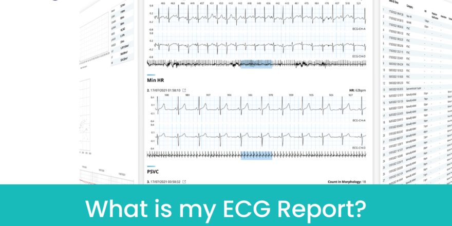 my-ecg-report