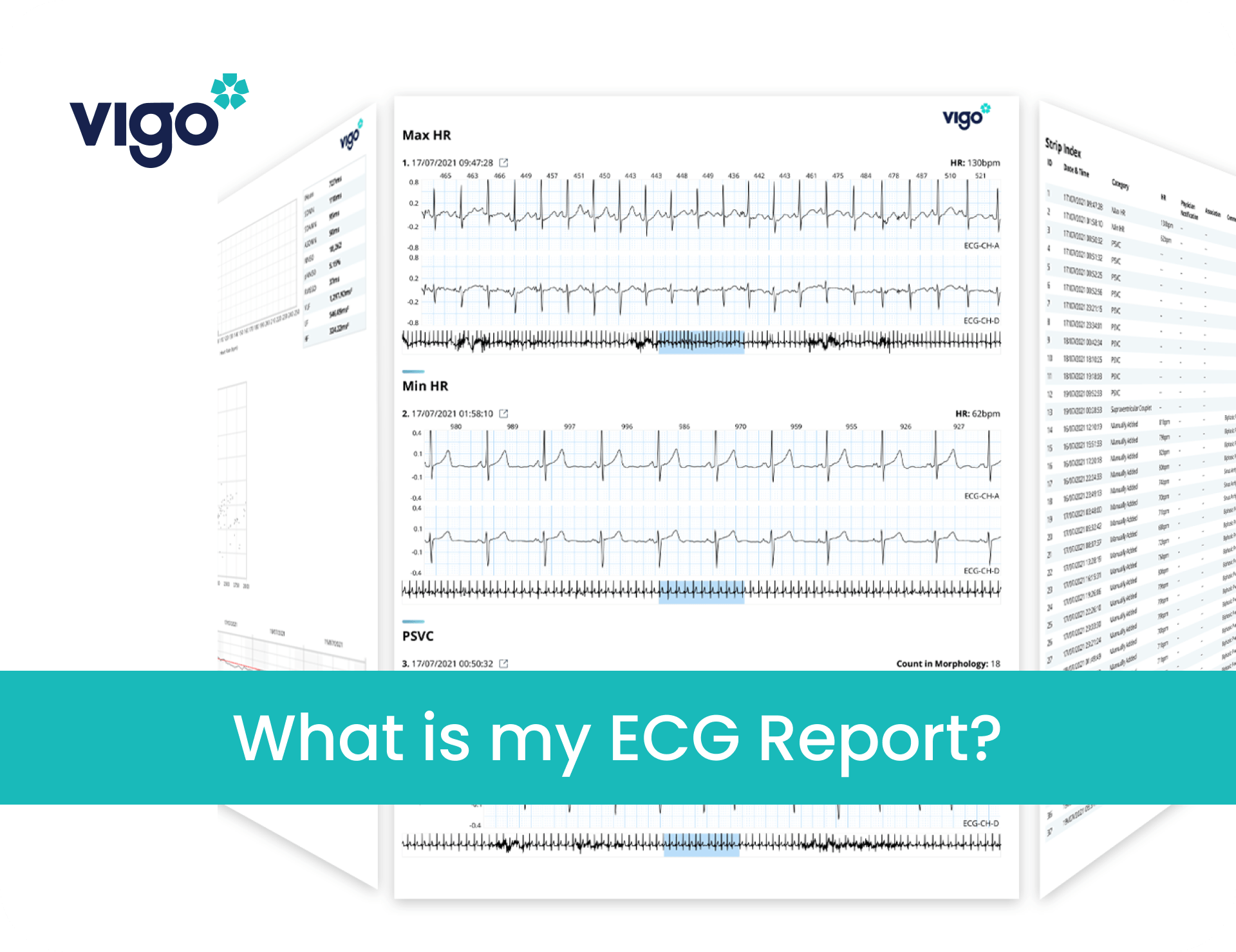 ECG Report you can trust